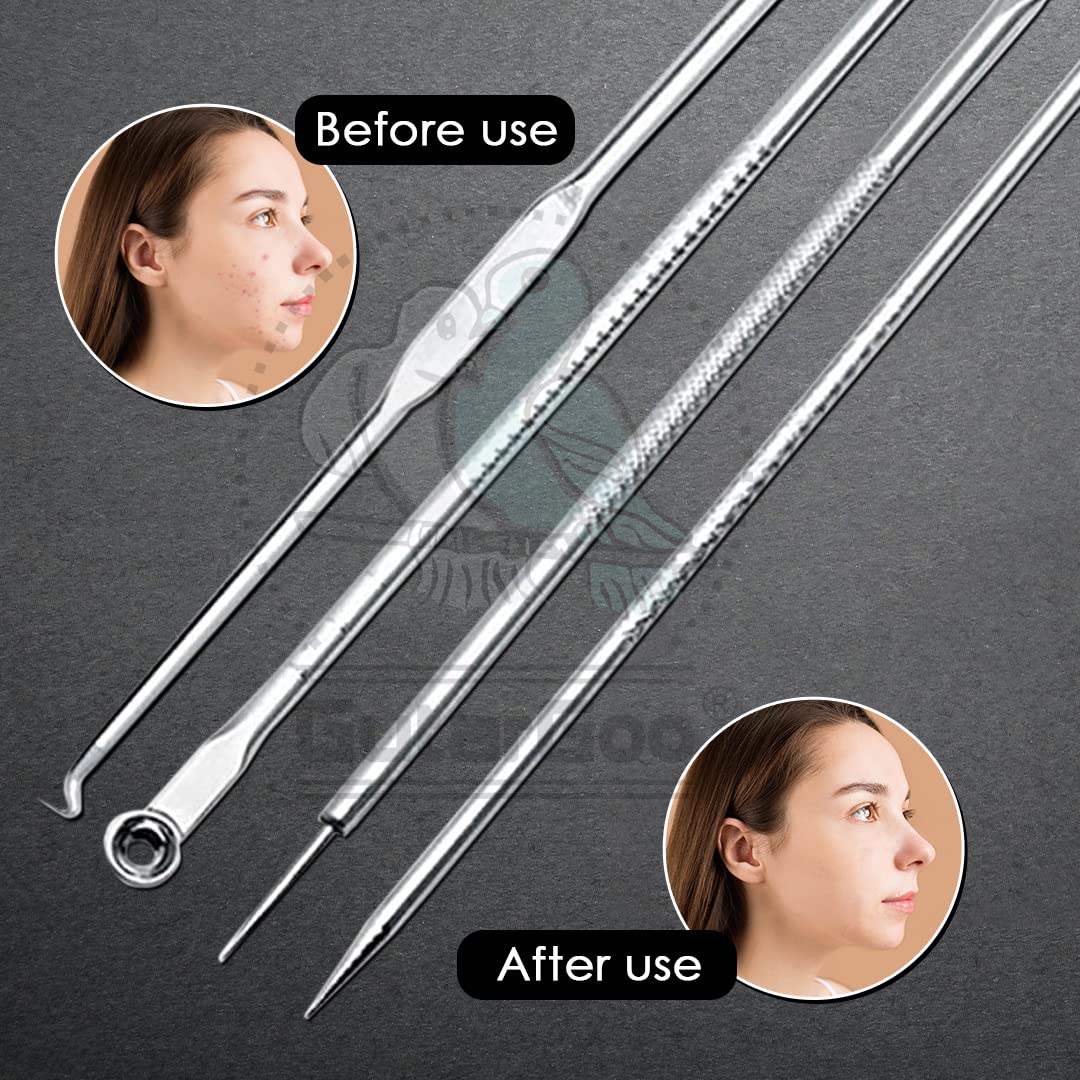 Gutargoo® 4-Piece Blackhead Remover Kit - Stainless Steel Pimple & Comedone Extractor Tool for Acne Treatment, Blemish Removal, Whitehead Popping - Perfect for Face & Nose Care for Women & Men - Ideal for Home Skincare Routine & Travel Beauty Essentials