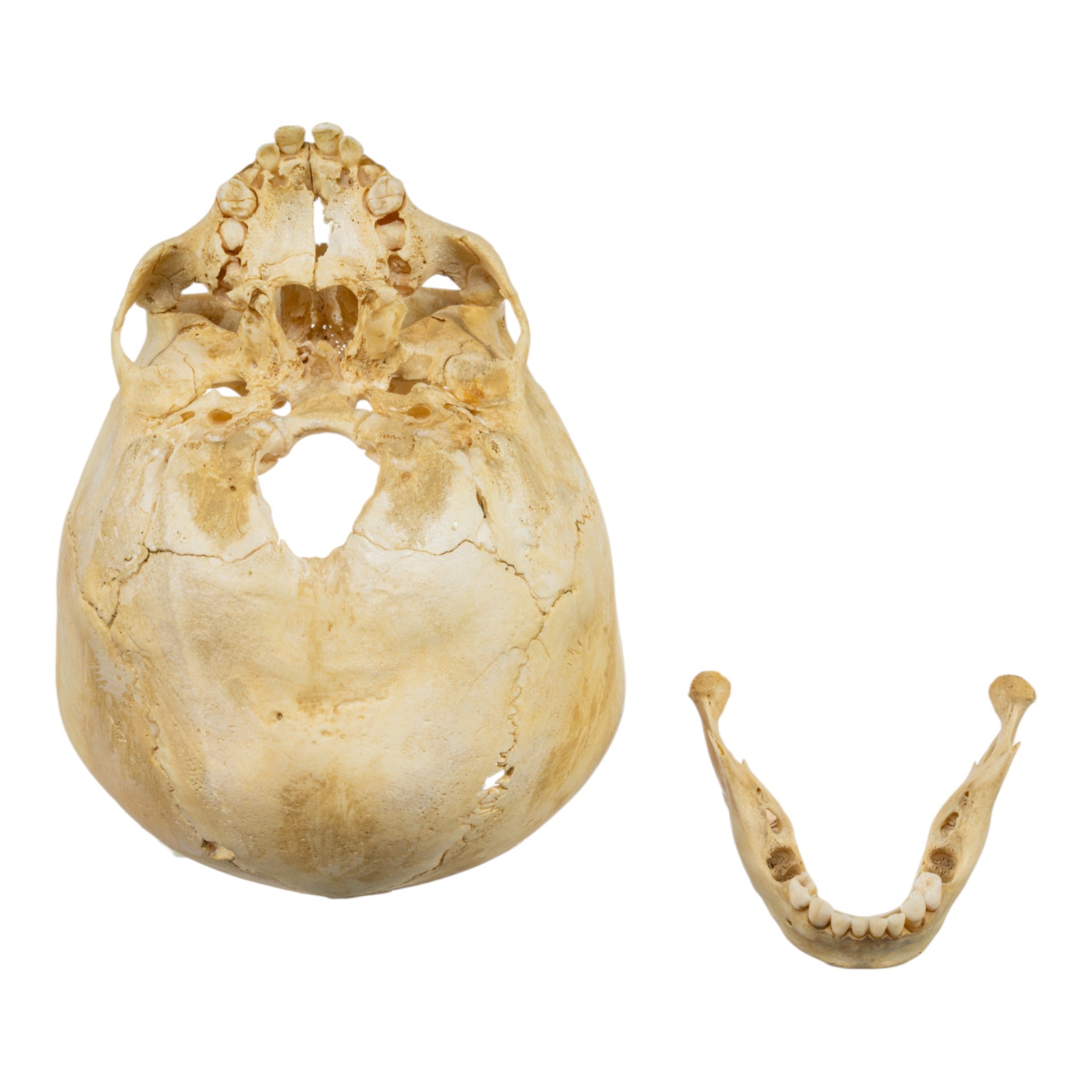 Authentic Real Human Child Skull Specimen - Partial Skull for Medical Study, Anatomy Education & Forensic Research | Ideal for Medical Students, Anthropologists & Science Classrooms