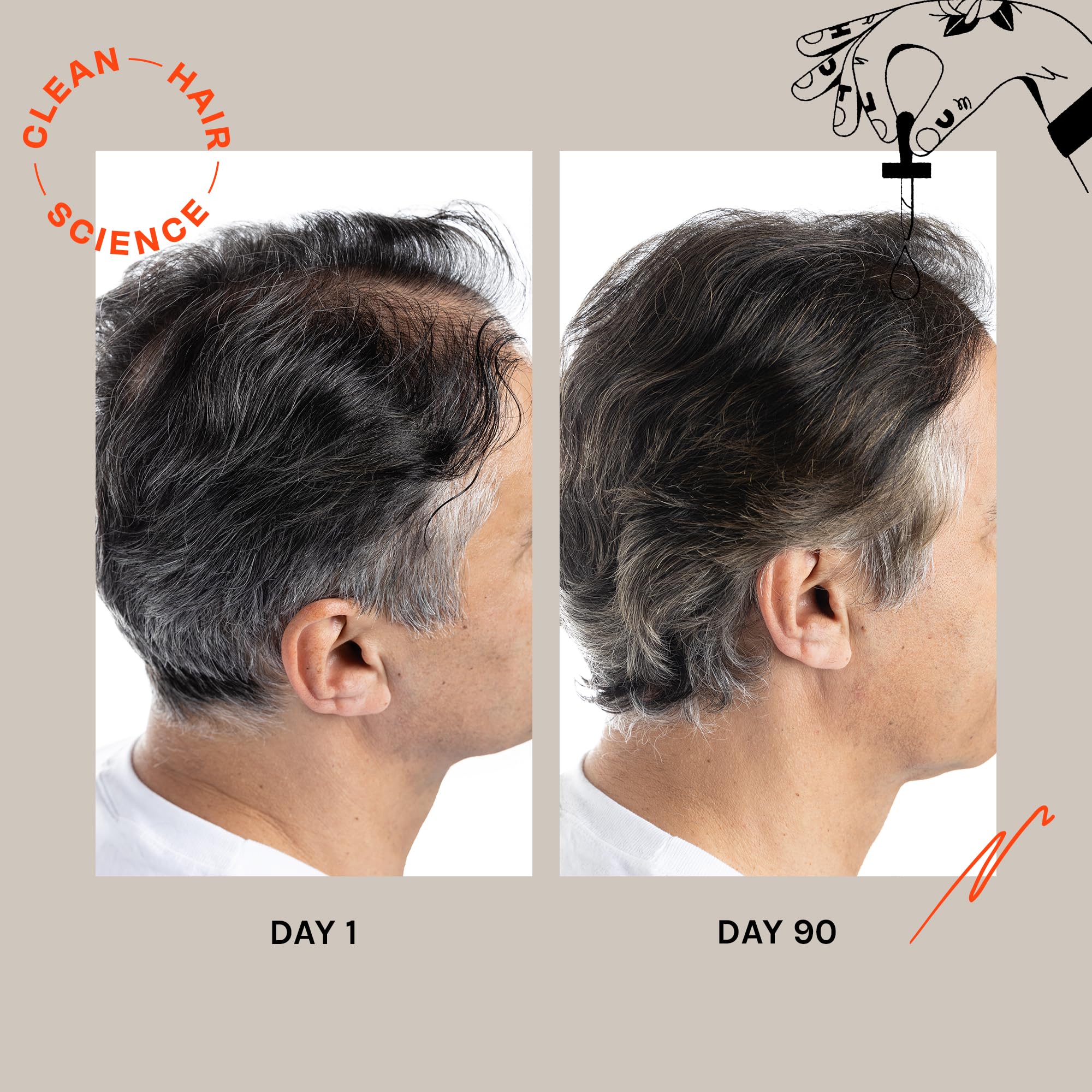 Advanced Hair Density Serum for Thicker & Fuller Hair - Safe & Effective Hair Loss Treatment (1 fl oz) - Perfect for Daily Use & Styling