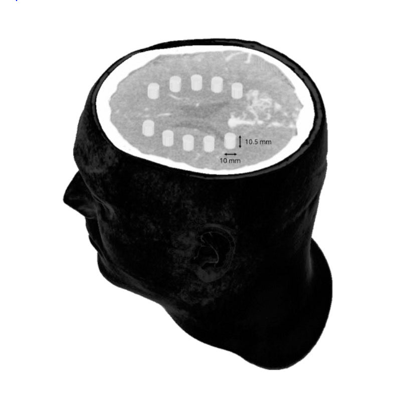 CTA AVM / Lesion Head and Neck Phantom for CT Scan & X-Ray Training - Medical Imaging Practice, Radiology Education, and Diagnostic Procedure Simulation