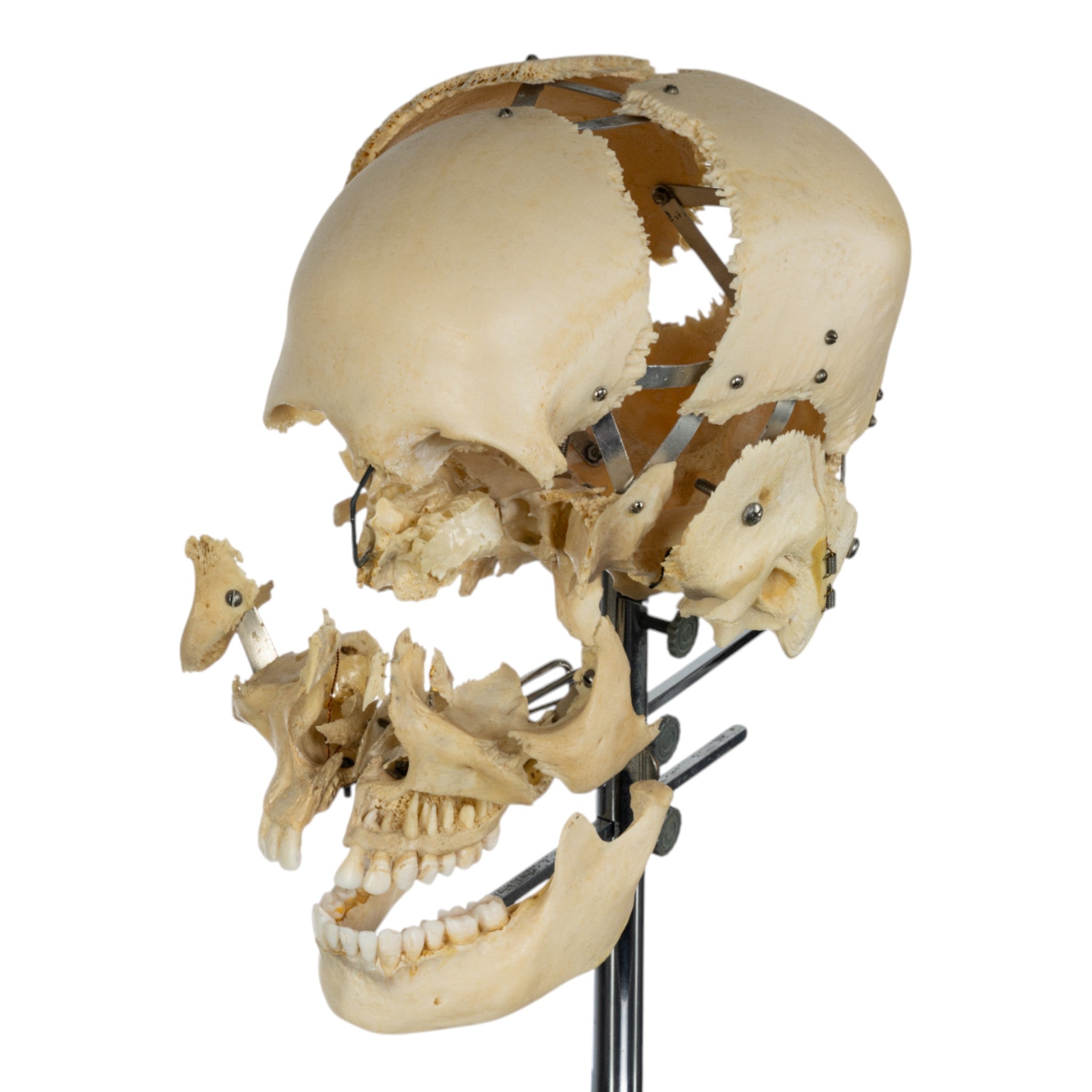 Real Human Exploded Skull Model on Display Stand - Perfect for Anatomy Study, Medical Education & Halloween Decor