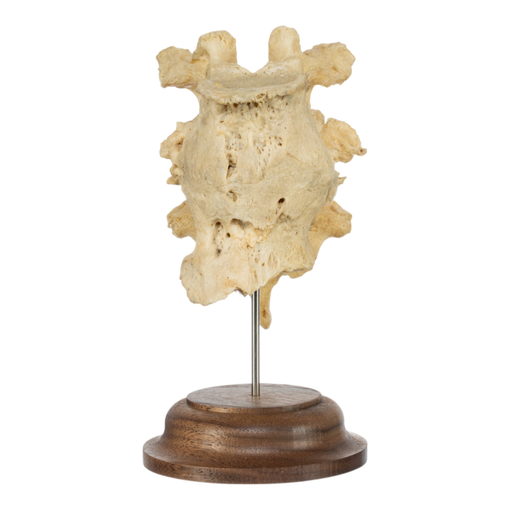 Authentic Human Fused Vertebrae Specimen - Medical Educational Display for Anatomy Study, Classroom Teaching & Doctor's Office Decoration
