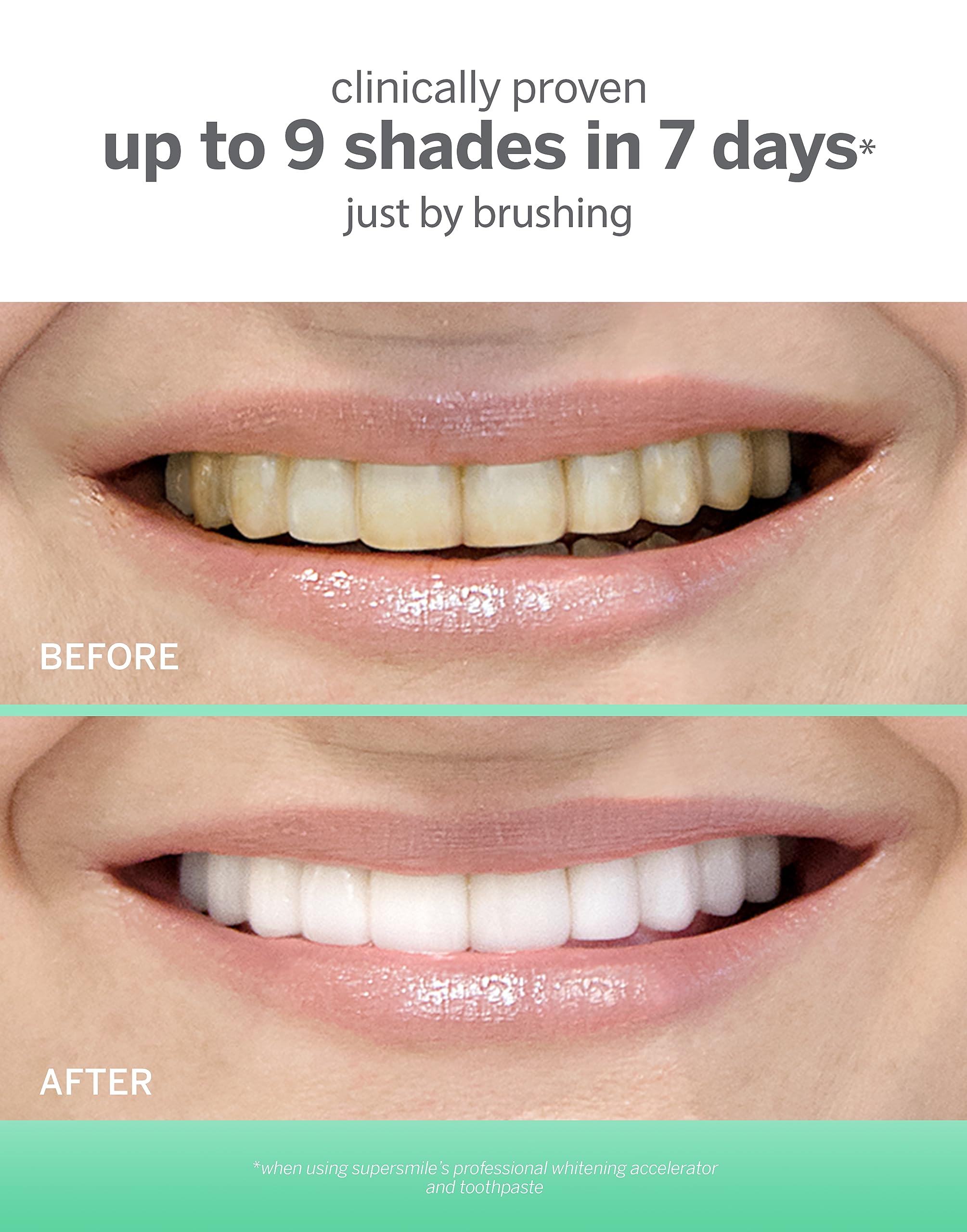 Supersmile Extra Whitening Toothpaste System - Large & Small Tubes with 2 Soft Bristle Toothbrushes for Daily Teeth Whitening and Oral Care at Home