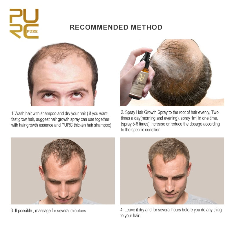Natural Ginger Hair Growth Spray for Thicker & Longer Hair - Promotes Scalp Health & Reduces Hair Loss - Perfect for Daily Use at Home or Salon