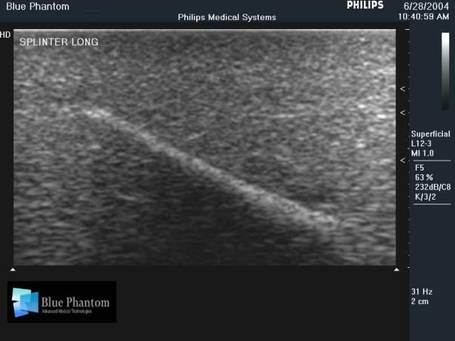 Foreign Body Identification Ultrasound Training Model - High-Quality Medical Simulation Tool for Emergency & Trauma Practice - Perfect for Medical Students, Nurses & First Responders