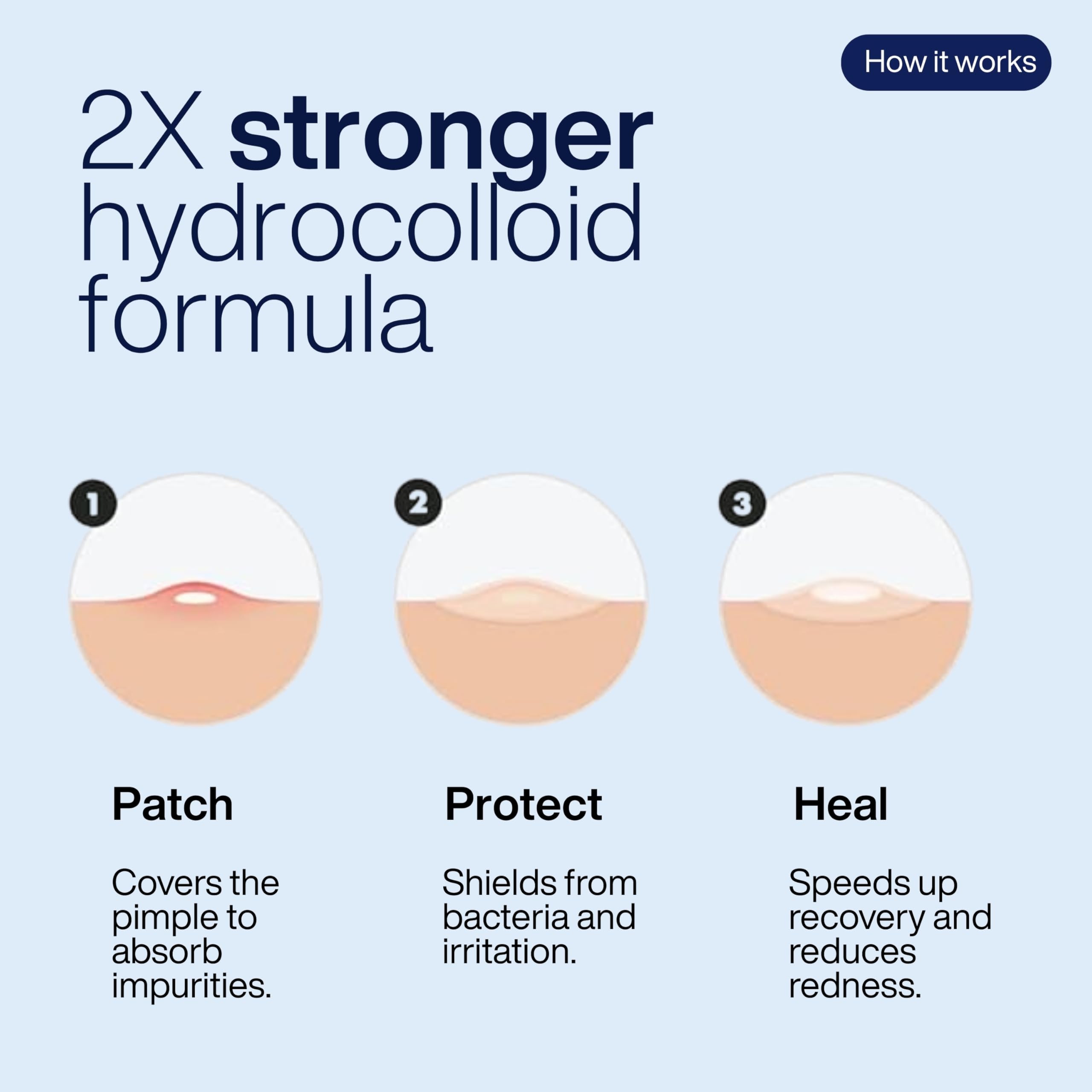 TOTAL ROUTINE Acne Recovery Patch - 72 Count Hydrocolloid Pimple Patches for Overnight Acne Treatment | Waterproof, Invisible Spot Cover for Active Breakouts | Reduces Pimples, Excess Oil & Blemishes | Perfect for Face, Back & Body Care Routine