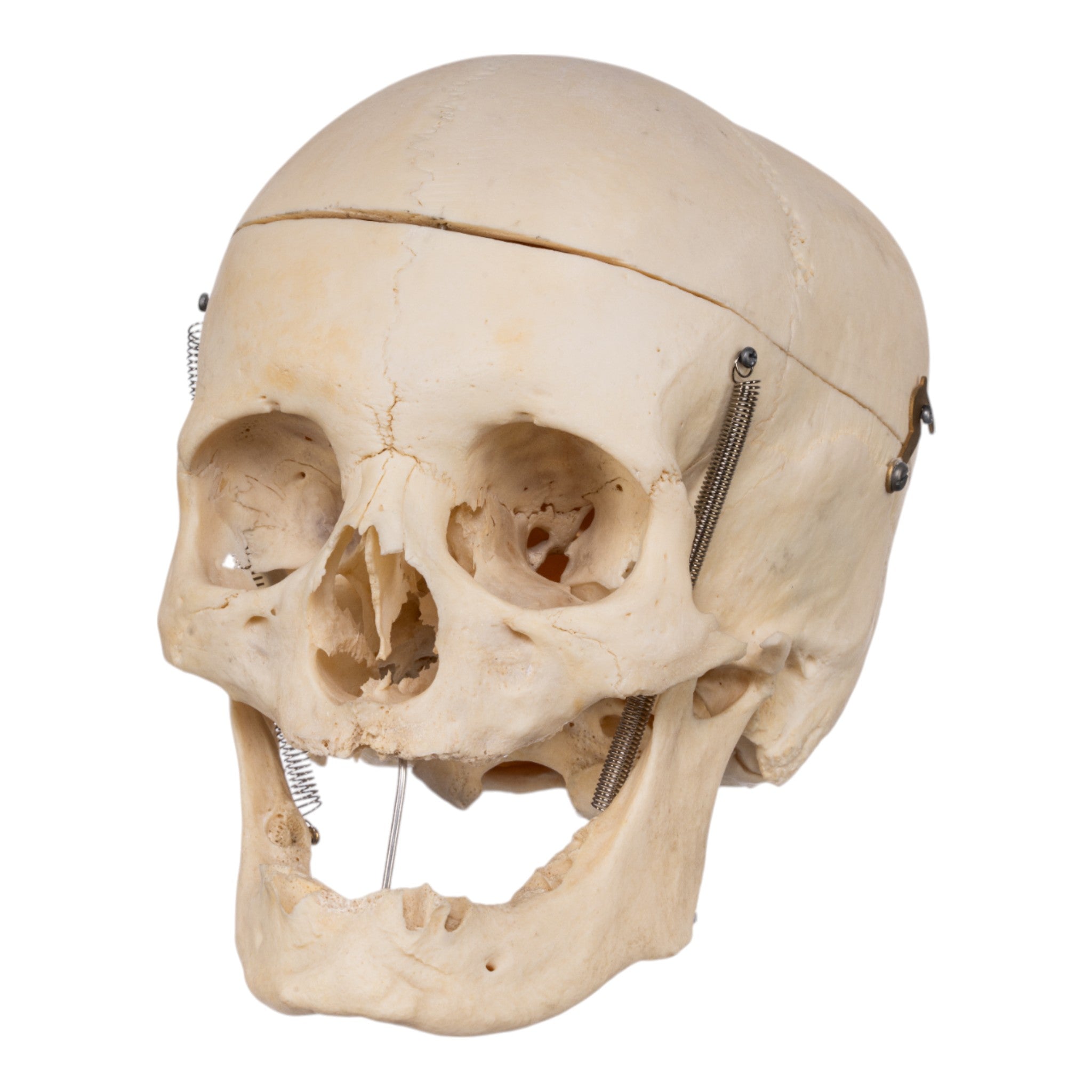 Authentic Real Human Skull for Medical Study, Halloween Decor, and Collectors - Perfect for Anatomy Education, Horror Displays, and Unique Home Decor