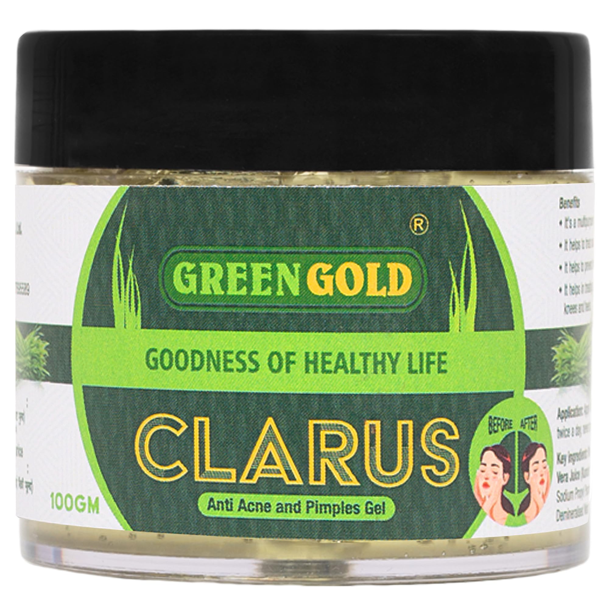 GreenGold Clarus Gel - Acne & Scar Treatment for Clear Skin | Hydrating Anti-Aging Face Gel with Glowing Formula | 100g | Perfect for Daily Skincare Routine & Post-Acne Care