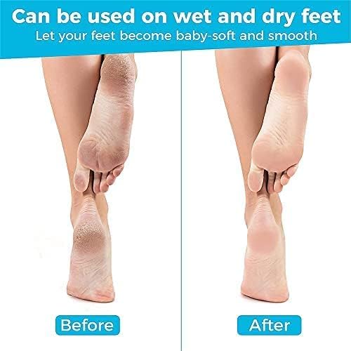 GLOW FIRST Extra Large Metal Foot File & Callus Remover (11x3 Inch) - Professional Pedicure Tool for Dead Skin Removal, Cracked Heels & Rough Feet - Perfect for Home Spa, Salon Treatments & DIY Foot Care