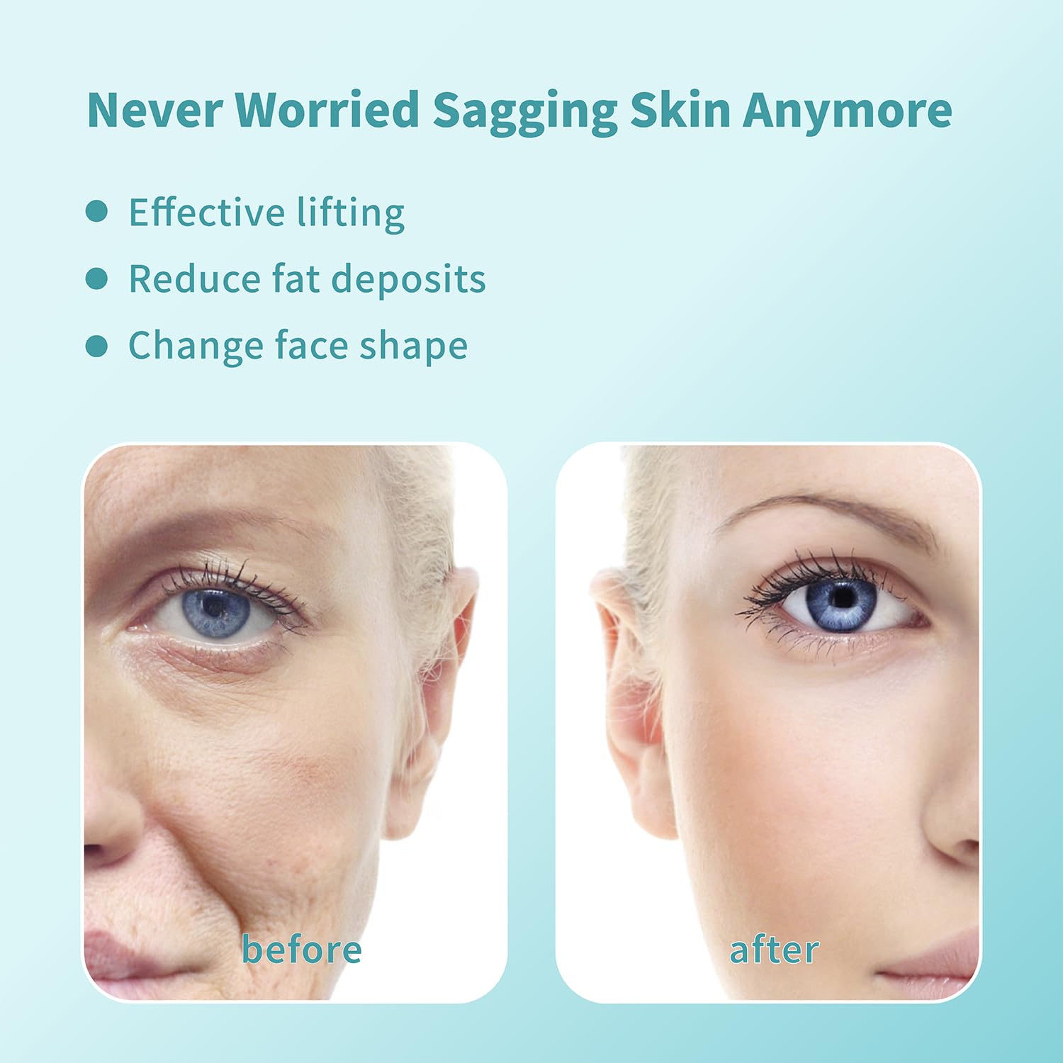PDO Threads Lift for Face - 40Pcs 27G 50mm Collagen Boosting Wrinkle Smoothing & Skin Tightening Treatment | At-Home Facial Rejuvenation & Anti-Aging Solution