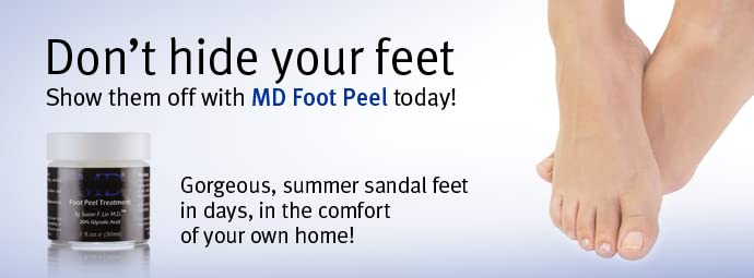 Factor Foot Peel Relief - Exfoliating Foot Cream for Cracked Heels & Calluses | Moisturizing Treatment to Soften Rough Feet (1 fl oz) | Perfect for Pedicures, Dry Skin Care & At-Home Foot Spa