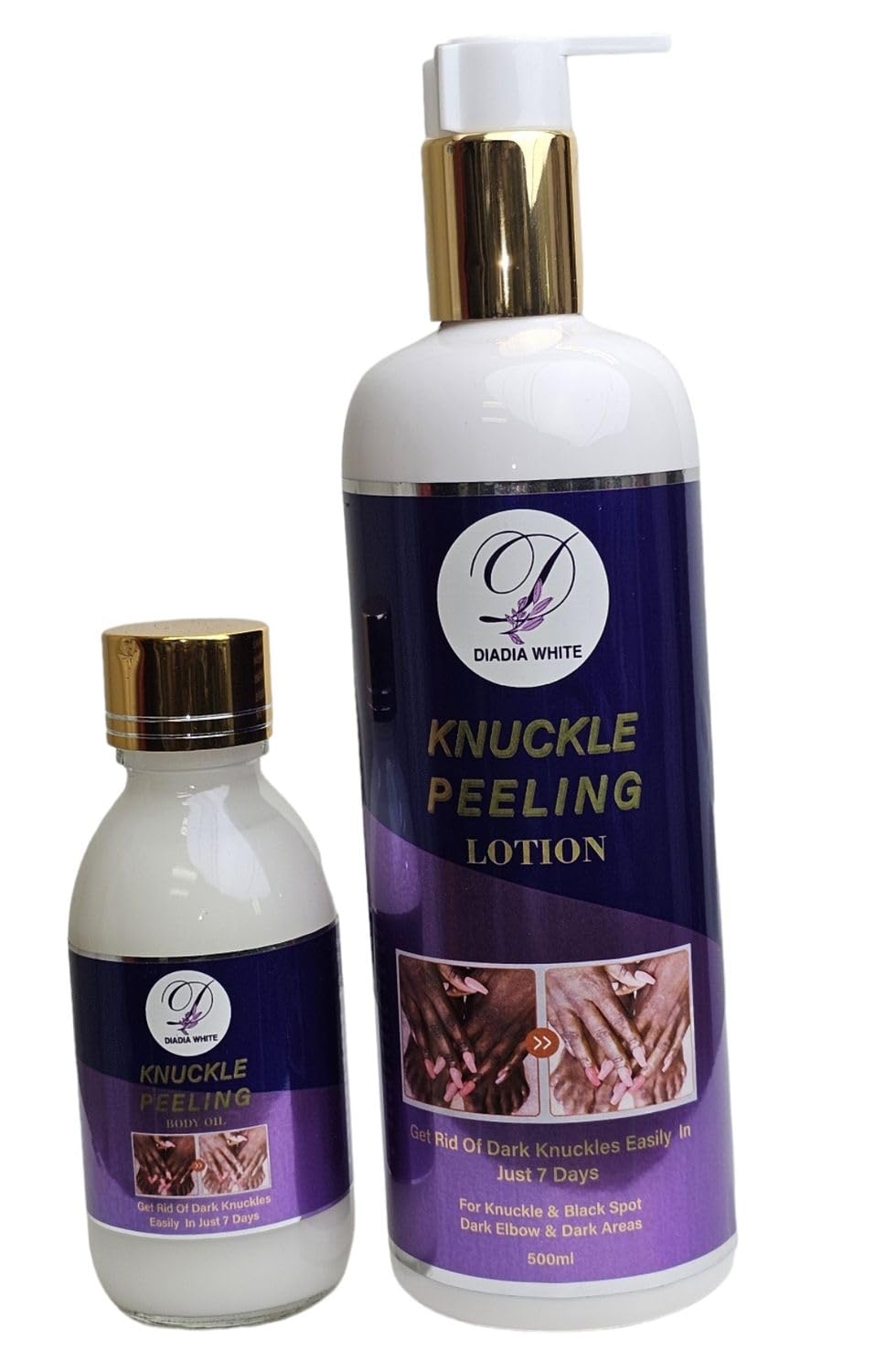 Best Dark Knuckle Treatment Lotion & Serum for Knees & Elbows - Brightening & Bleaching Cream for Dark Spots - Effective Skin Radiance Solution for Smooth, Even Tone (Ideal for Dry Skin & Hyperpigmentation)