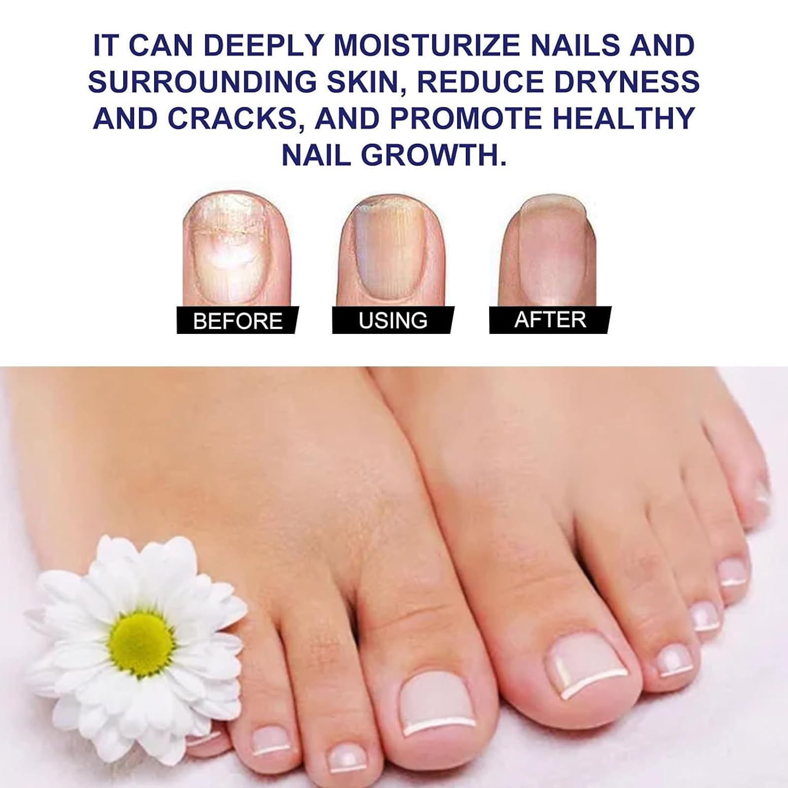 **Organic Plant Drops for Nail & Toenail Care - Oregano Tea Tree Oil Blend (10ml/0.34 Fl.oz, 2-Pack) - Natural Fungus Treatment for Stronger, Healthier Nails - Perfect for Pedicures & At-Home Nail Care**