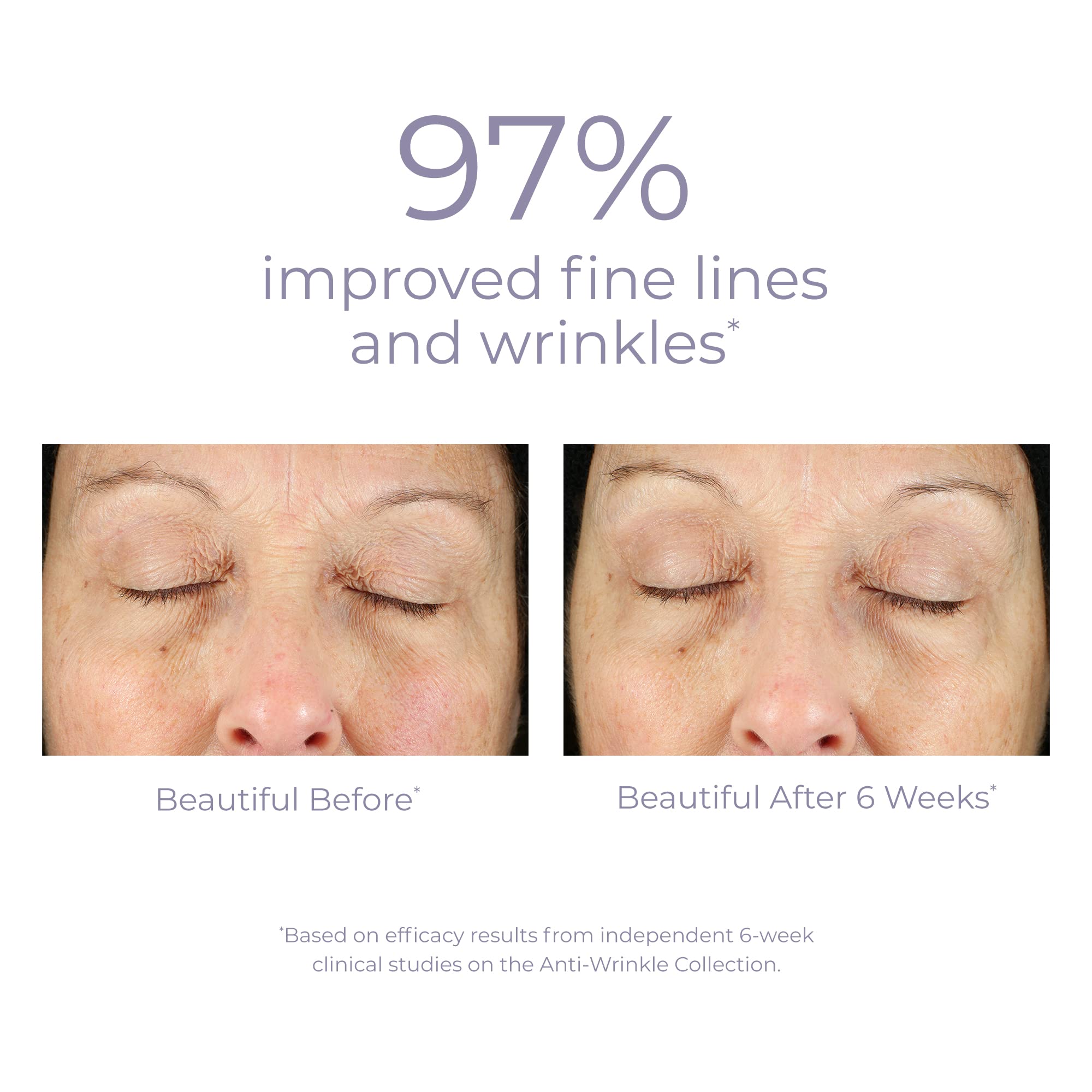 Derma E Anti-Wrinkle Eye Cream with Retinol, Grape Seed & Reishi Mushroom - Hydrating Under Eye Treatment for Dark Circles, Puffiness & Fine Lines - 1/2 oz Anti-Aging Serum - Perfect for Nighttime Skincare Routine & Travel