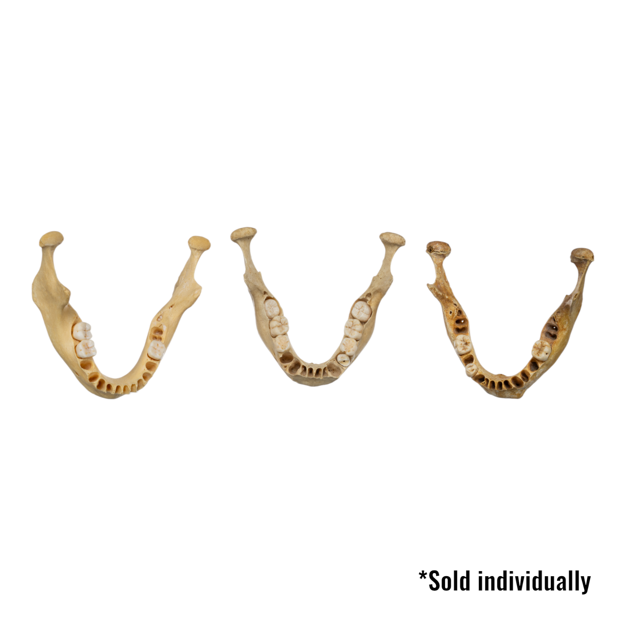 Authentic Real Human Mandible Bone - Young Adult Single Jawbone Specimen for Medical Study, Anatomy Education & Forensic Research