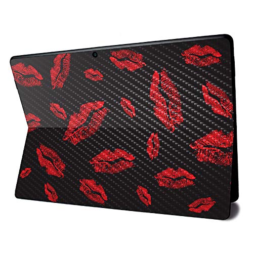 Kiss Me