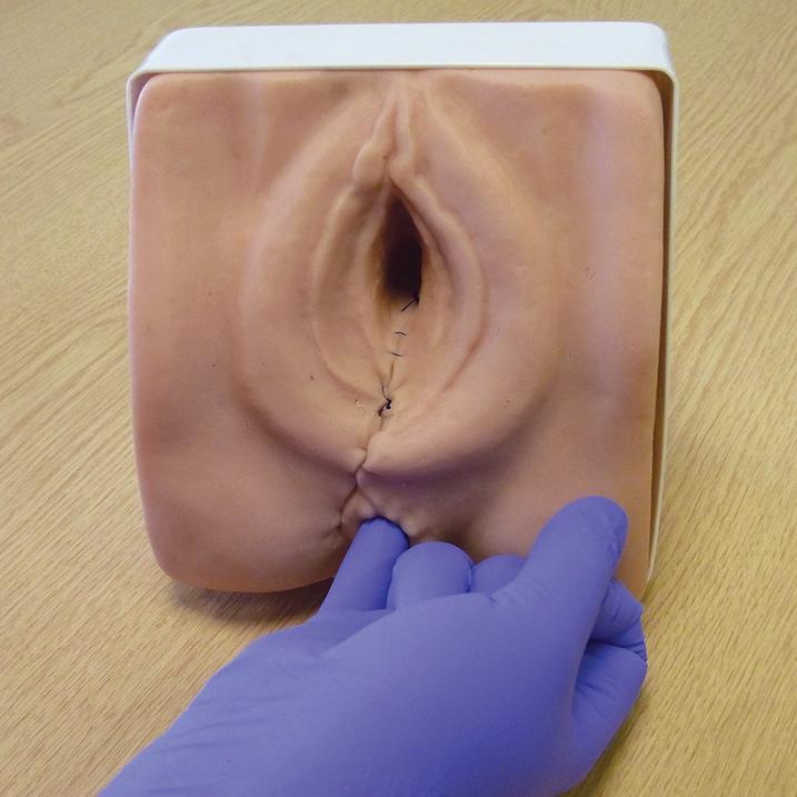 Episiotomy Suturing Perineal Repair Trainer Kit - Medical Practice Model for OBGYN Training & Midwife Skills Development - Perfect for Clinical Simulation and Surgical Education