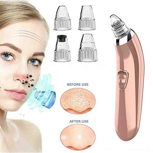 Electric Blackhead Remover Vacuum - Pore Cleaner for Face & Nose - Acne Care Kit