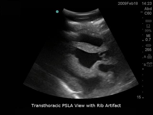 FAST Exam Real Time Ultrasound Training Model - Transthoracic Only for Emergency Medicine & Trauma Assessment Practice (Medical Simulation, Sonography Education, TTE Training)