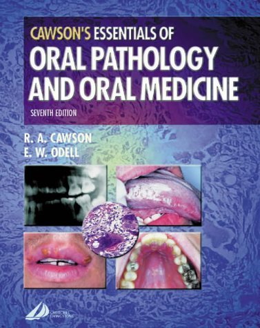 Cawson's Essentials of Oral Pathology and Oral Medicine Textbook - Comprehensive Guide for Dental Students & Professionals - Perfect for Clinical Practice, Board Exams & Dental Education