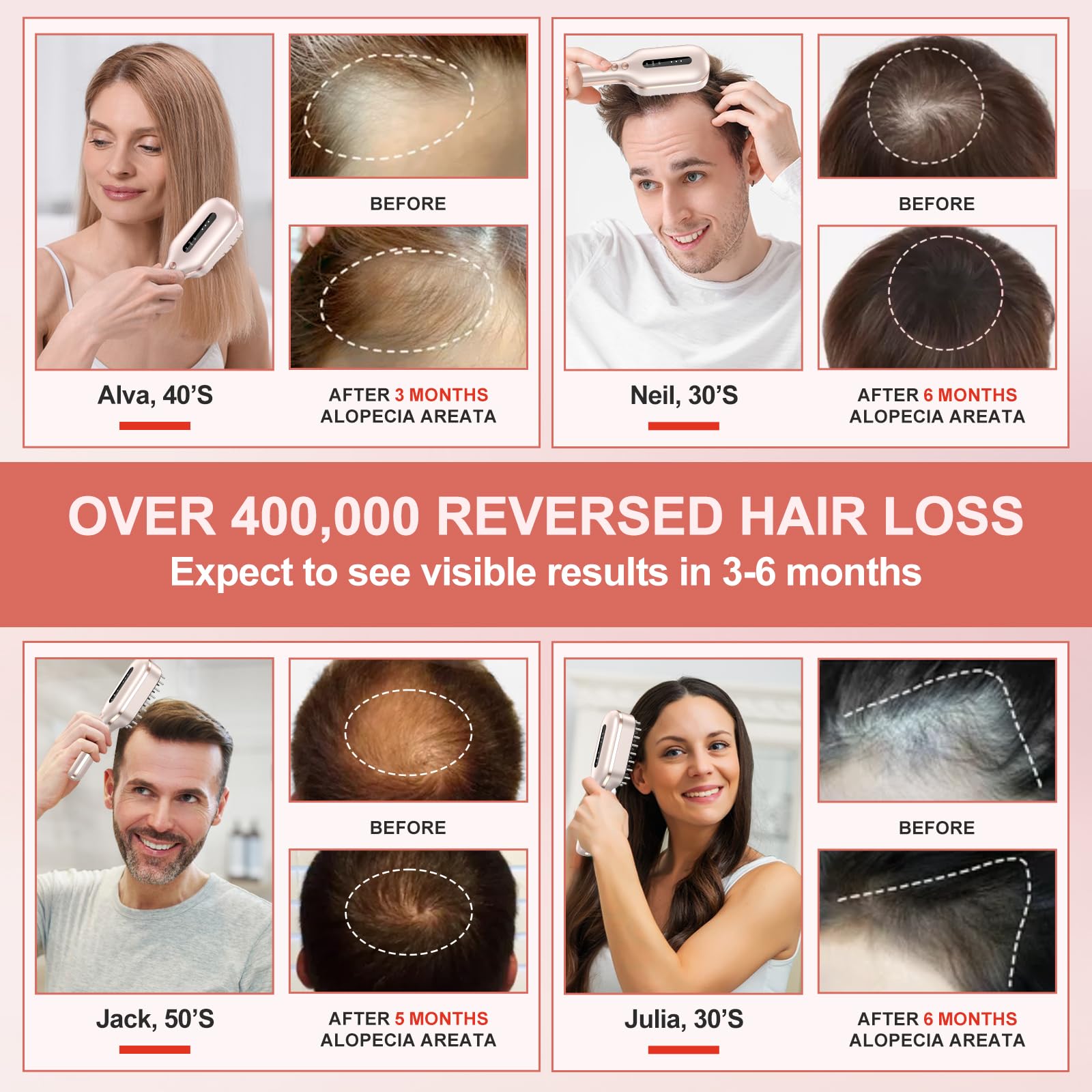 FDA Cleared Laser Therapy Hair Growth Comb for Men & Women - Stimulates Hair Growth, Reverses Thinning, Regrows Denser Fuller Hair - Effective Hair Loss Treatment for Home Use & Salon Treatments
