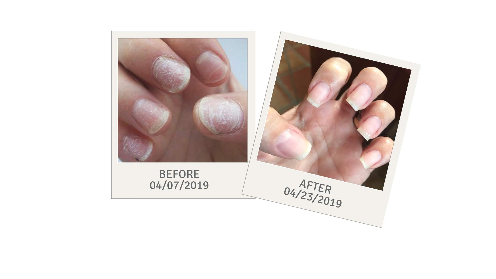 Drs. Kline + Green Hydrate Damaged Nail Treatment 1.69 oz - Repair & Strengthen Brittle Nails for Healthy, Beautiful Hands - Perfect for Salon & Home Nail Care