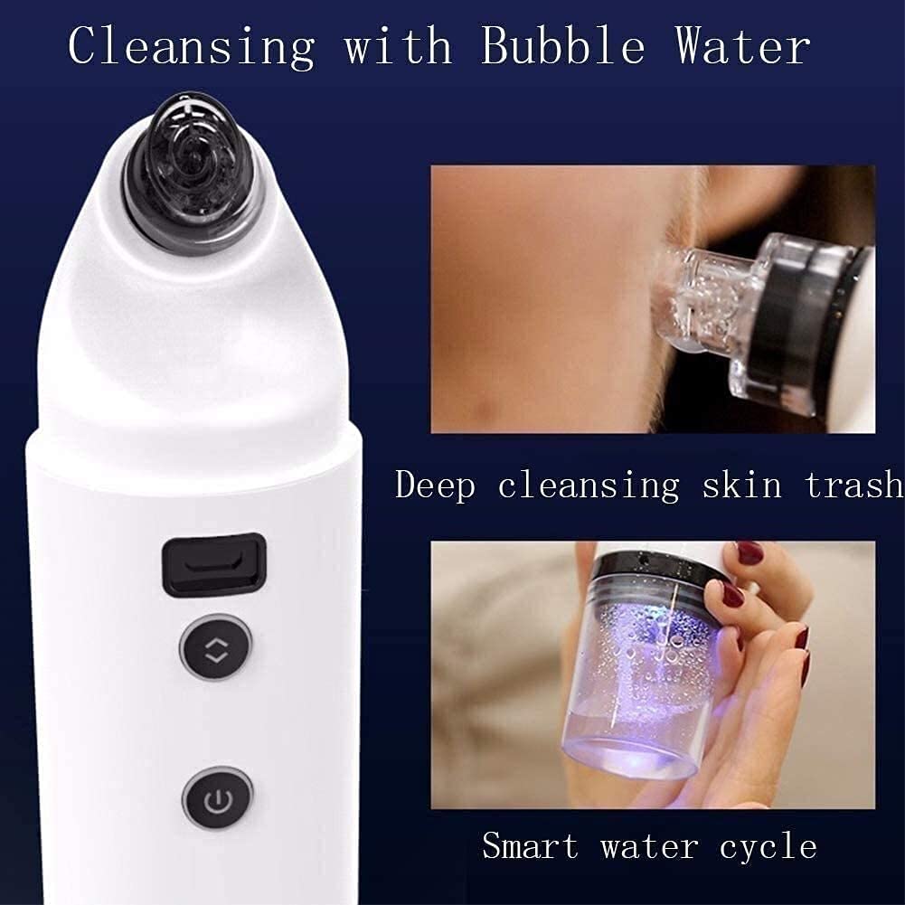 Electric Blackhead Remover Vacuum - Portable USB Rechargeable Pore Cleaner & Acne Comedone Extractor Kit for Women & Men (White) | Perfect for Daily Skincare Routine & Travel