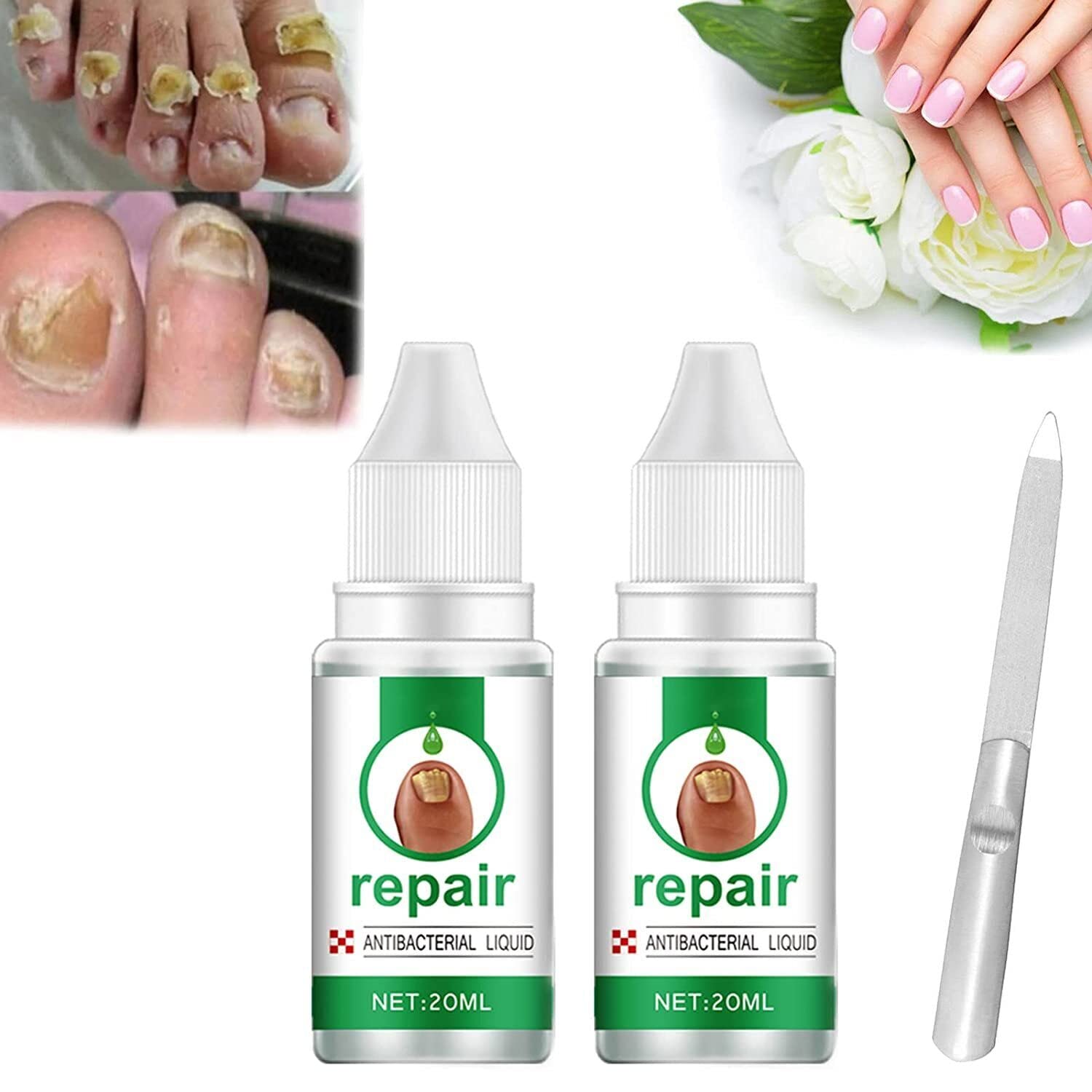 2Pcs Fungal Nail Treatment for Toenails - Antifungal Nail Repair Solution, Toenail Fungus Removal & Foot Care Essence - Effective for Athlete's Foot & Ingrown Toenails - Perfect for Daily Foot Hygiene & Nail Health Maintenance