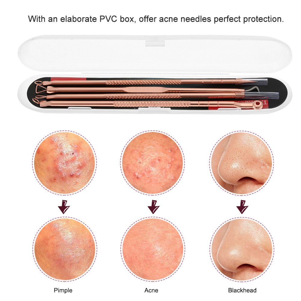 4Pcs Stainless Steel Acne Needle Set - Double-Ended Pimple & Blackhead Remover Tool for Facial Cleaning | Professional Comedone Extractor Kit for Skin Care & Blemish Treatment at Home or Salon Use