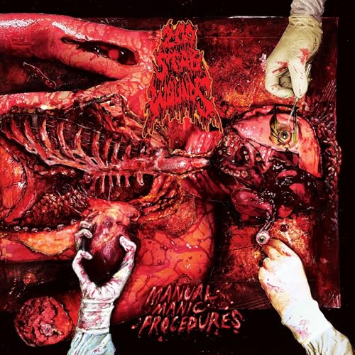 200 Stab Wounds - Manual Manic Procedures CD | Death Metal Music Album | Perfect for Mosh Pits & Extreme Metal Collectors