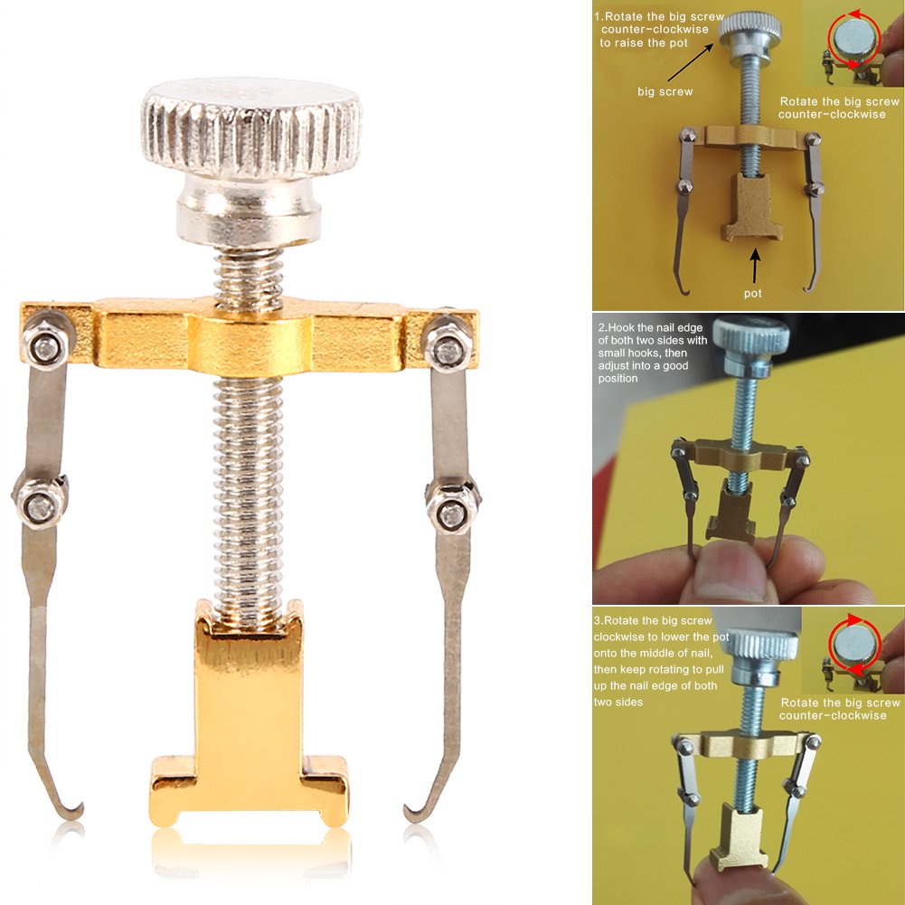 Professional Ingrown Toenail Corrector Kit - Pain Relief & Treatment for Ingrown Nails, Paronychia - Pedicure Tools for Toe Care & Nail Correction - Perfect for Home Use & Salon Treatments