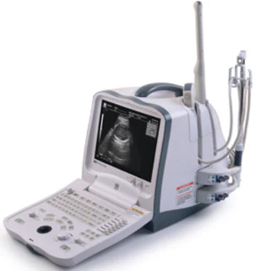Mindray DP 6600 Portable Ultrasound Machine - High-Resolution Imaging for Medical Diagnostics | Perfect for Clinics, Emergency Rooms & Mobile Healthcare Services