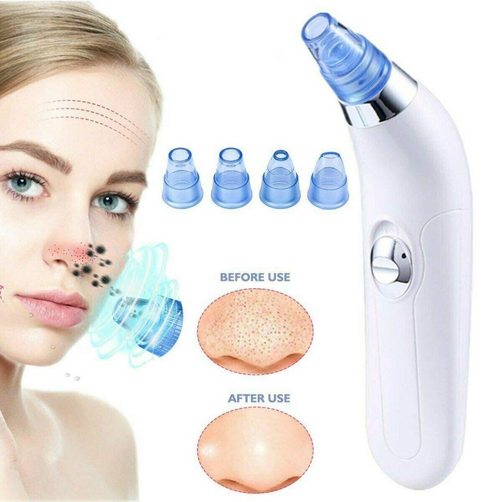 DIYASHI® Blackhead Vacuum Pore Cleaner - Acne & Pimple Remover for Nose & Face - Deep Cleansing Device for Blackheads & Clogged Pores | Perfect for At-Home Skincare & Spa Treatments
