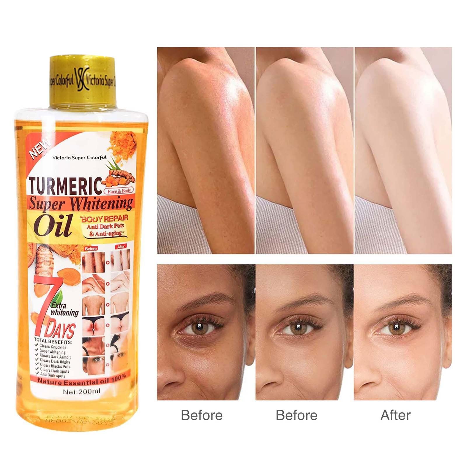 Turmeric Oil for Face & Body - Whitening, Anti-Aging, Wrinkle Reduction & Dark Spot Corrector | Natural Skin Lightening Moisturizer | Essential Oil for Glowing Skin | Perfect for Daily Skincare Routine & Nighttime Treatment (1pc)