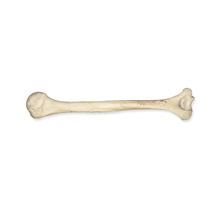 Real Human Humerus Bone - Authentic Medical Specimen for Anatomy Study, Research & Education - Perfect for Medical Students, Doctors & Science Enthusiasts