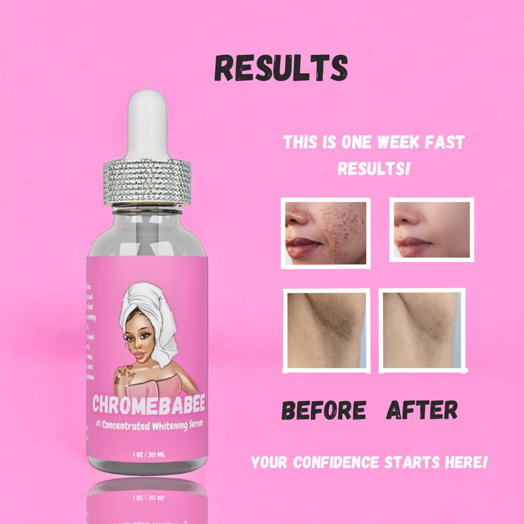 Brightening & Whitening Serum with Vitamin E & AHA - 1 Fl oz / 30 ml - Face, Body, Armpits, Hands & Knees Dark Spot Corrector - Perfect for Daily Skincare Routine & Evening Skin Tone