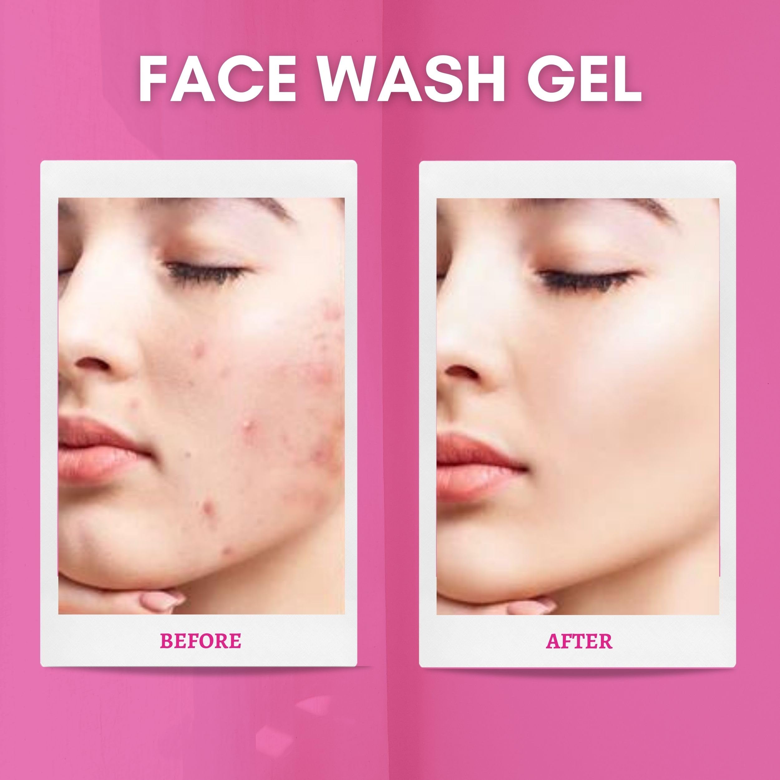 ACQUIN Anti-Acne & Anti-Wrinkle Face Wash 100ml - Gentle Cleanser for Oily & Sensitive Skin - Perfect for Daily Skincare Routine & Travel