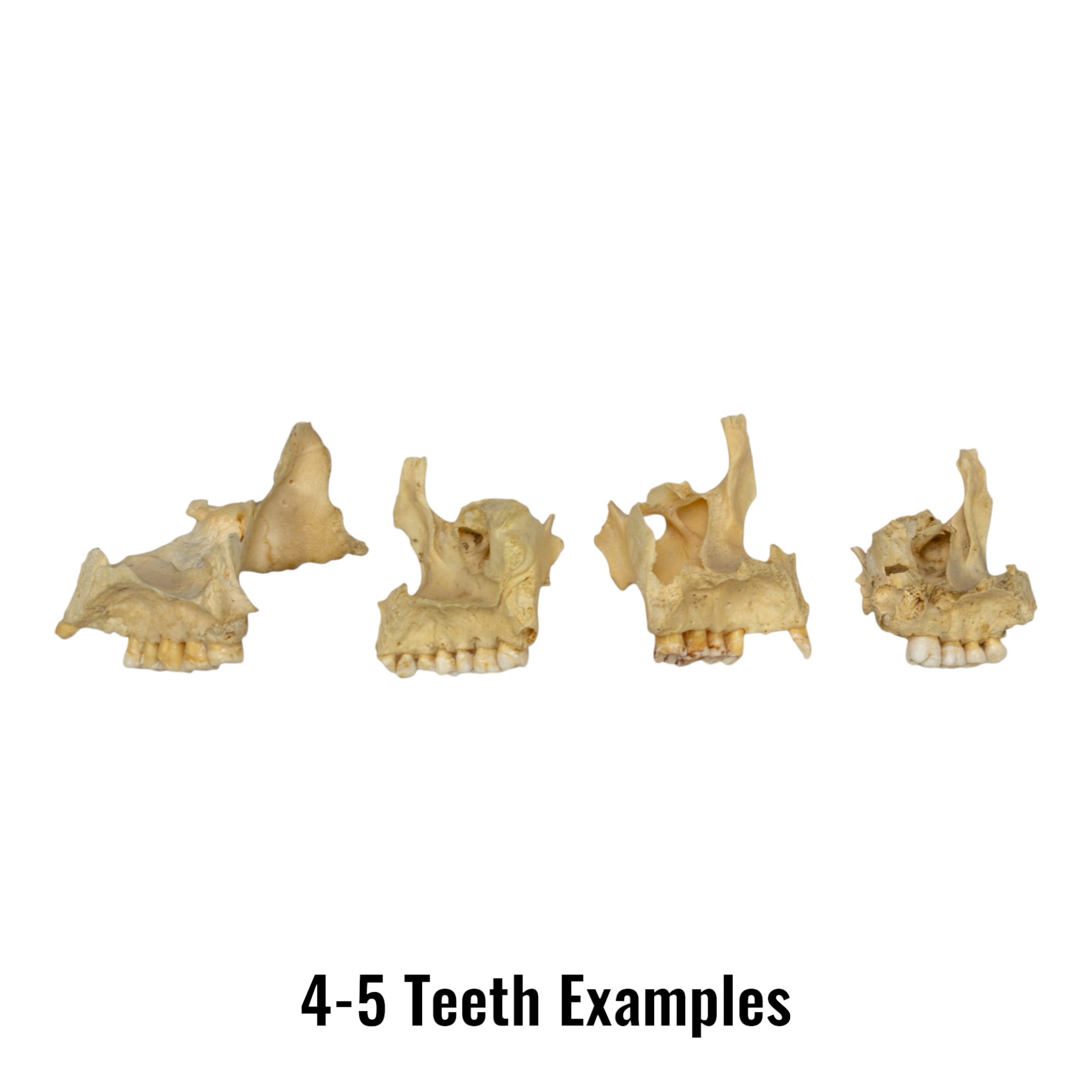 Authentic Human Maxillary Bone - Single Specimen for Medical Study, Dental Education, and Anatomy Research | Ideal for Students, Doctors, and Science Enthusiasts