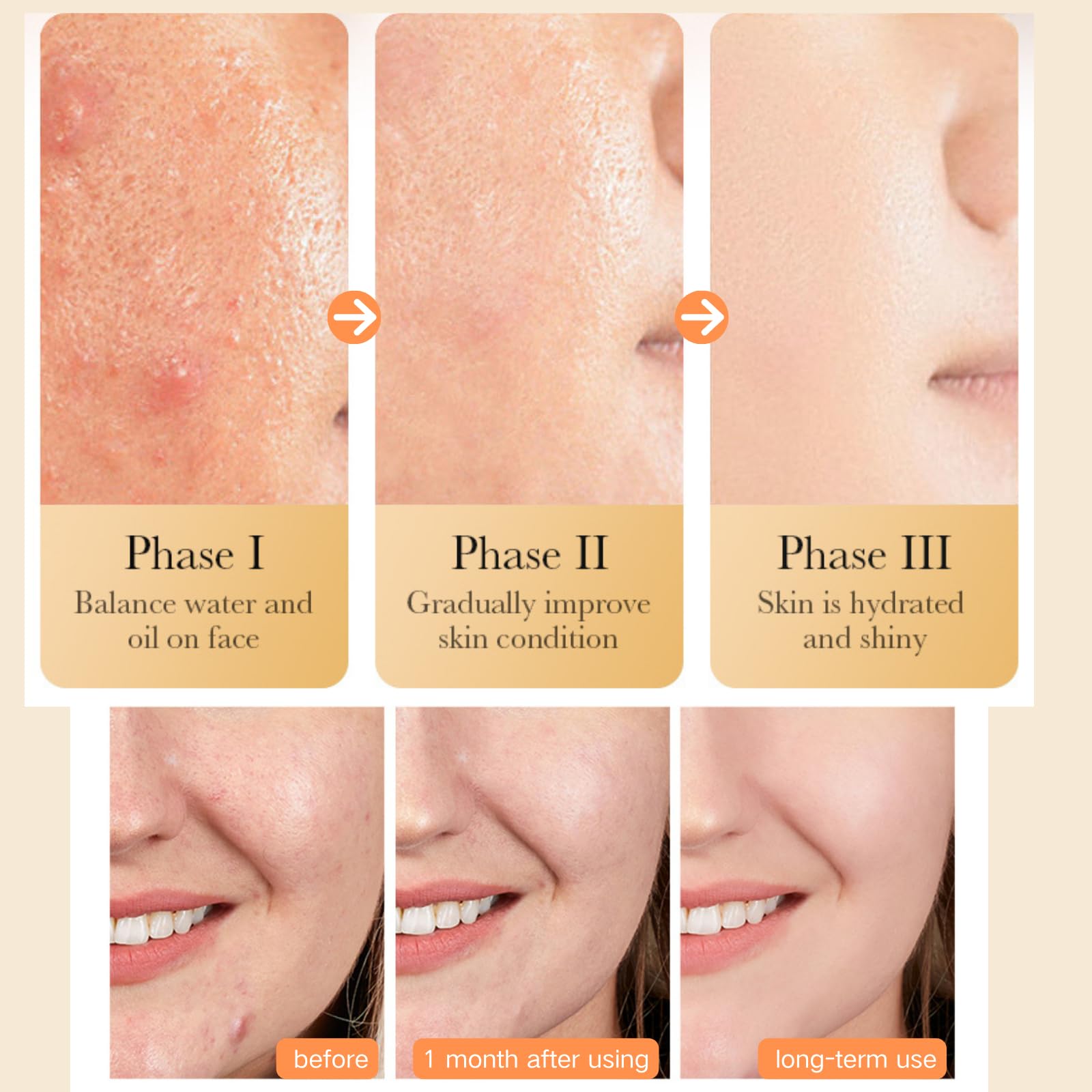Turmeric Face Cream for Dry & Oily Skin - Hydrating Anti-Aging Moisturizer for Women - Korean Skincare for Acne Care & Daily Use