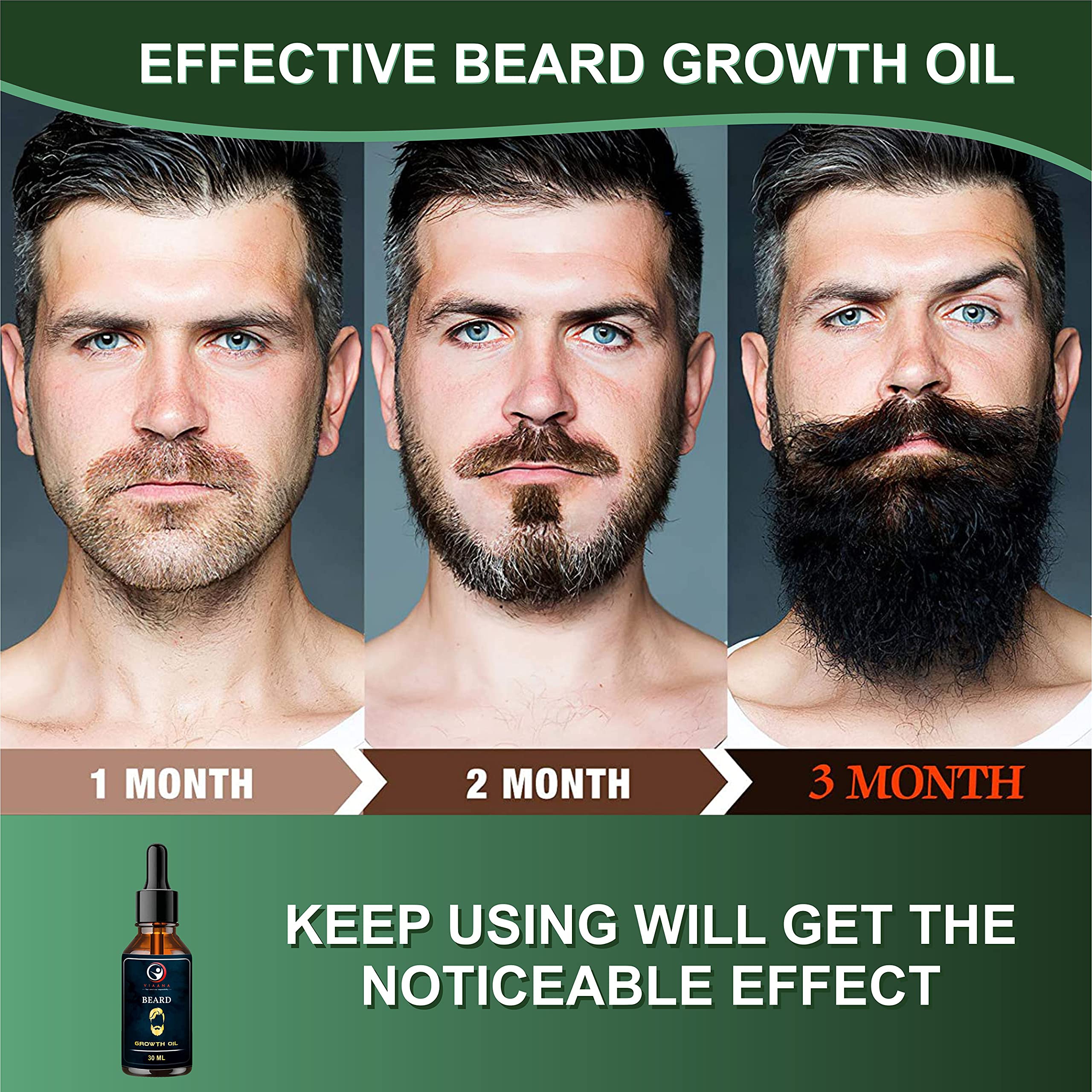 VIAANA Beard Growth Oil with Onion Oil - Promotes Thicker, Fuller Beard Growth | Nourishing Formula with Sweet Almond Oil, Olive Oil & Vitamin E | 30ml Bottle | Ideal for Daily Beard Care & Styling
