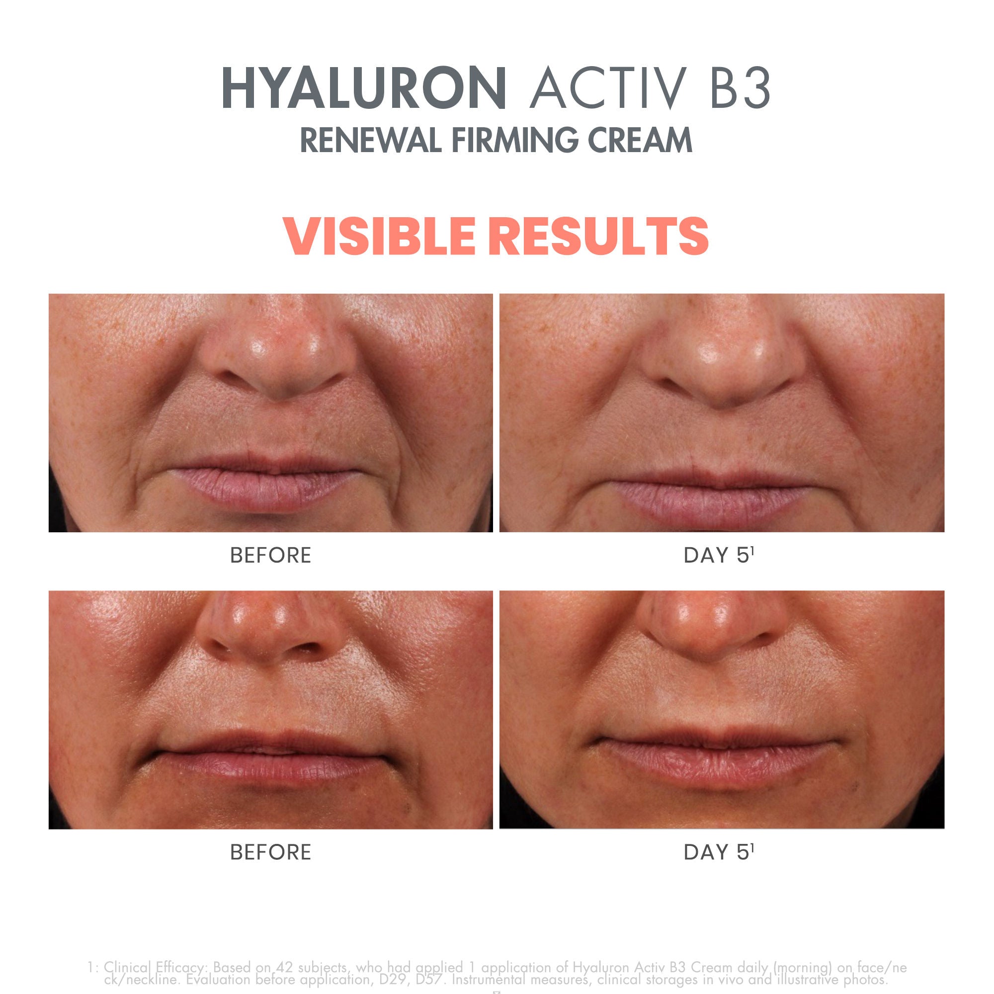 Hyaluronic Acid B3 Renewal Firming Face Cream - Anti-Aging Moisturizer for Wrinkles & Fine Lines - Day & Night Skincare Routine
