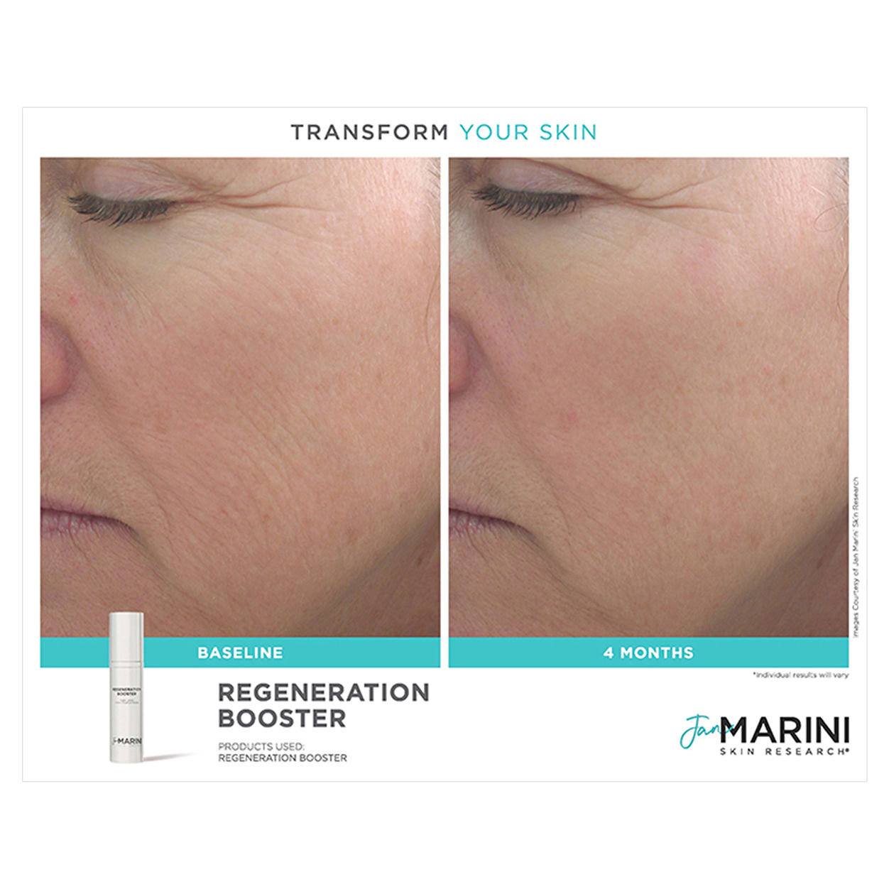 Age Intervention Regeneration Booster Serum | Anti-Aging Face Cream for Wrinkles & Fine Lines | Day & Night Moisturizer for Youthful Skin