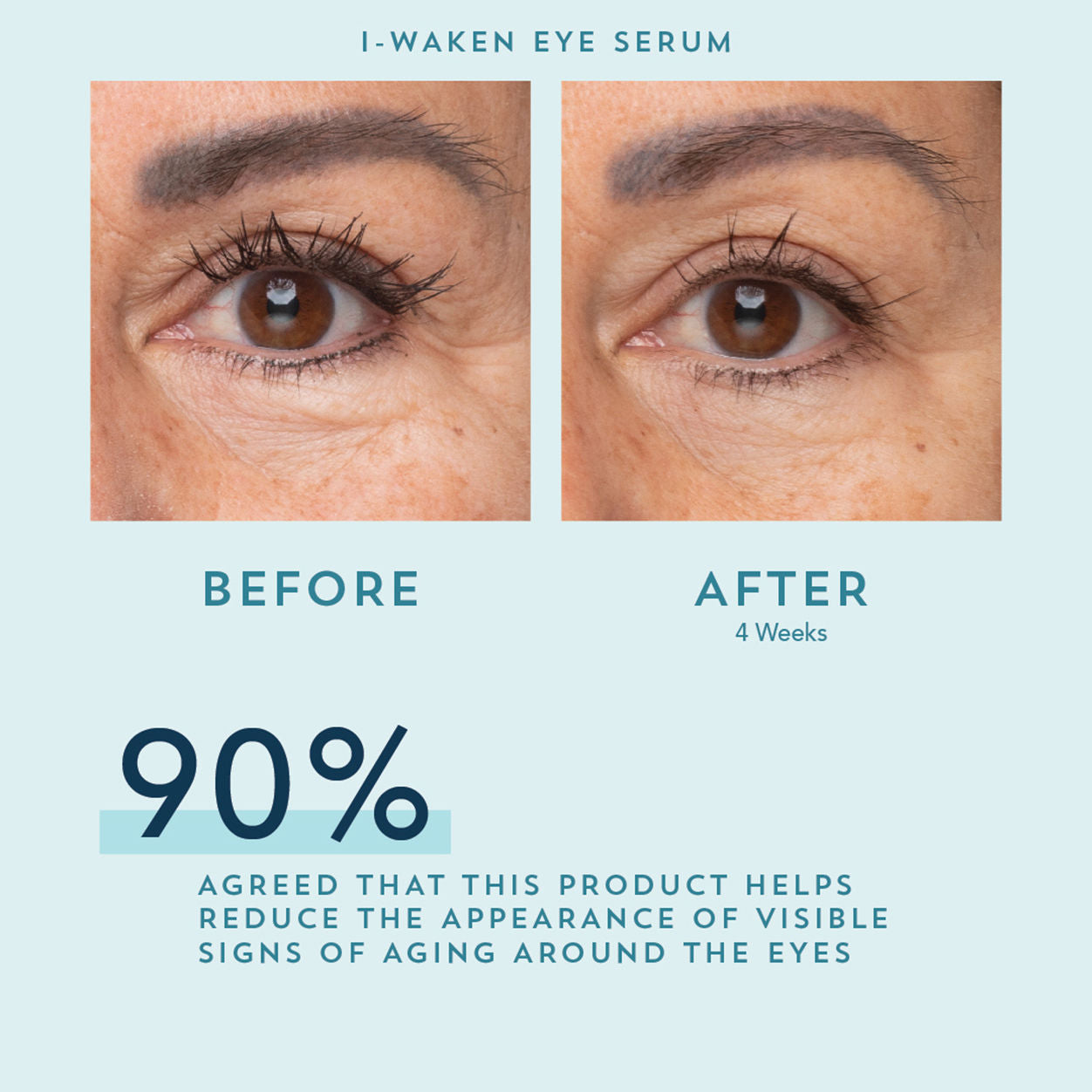 I Waken Eye Serum - Dark Circle & Puffiness Treatment for Bright, Youthful Eyes | Day & Night Use for Men & Women