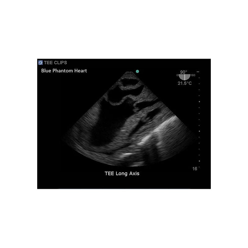 FAST Exam Ultrasound Training Model - Transthoracic & Transesophageal Echo Simulator for Cardiac Sonography Practice (Ideal for Medical Students, Ultrasound Tech Training & Clinical Skills Development)