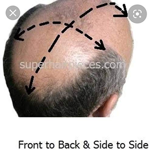 Premium Monofilament Human Hair Toupee for Men & Boys - 7x5 Hair Patch System, Natural Look & Comfort - Ideal for Daily Wear, Special Occasions & Hair Loss Solutions