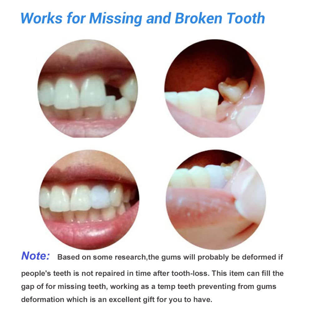 Tooth Repair Kit - Moldable False Teeth Thermal Fitting Beads for Snap-On Instant Smile | DIY Dental Solution for Missing Teeth & Gap Filling | Perfect for Travel, Emergencies, and Confidence Boosting