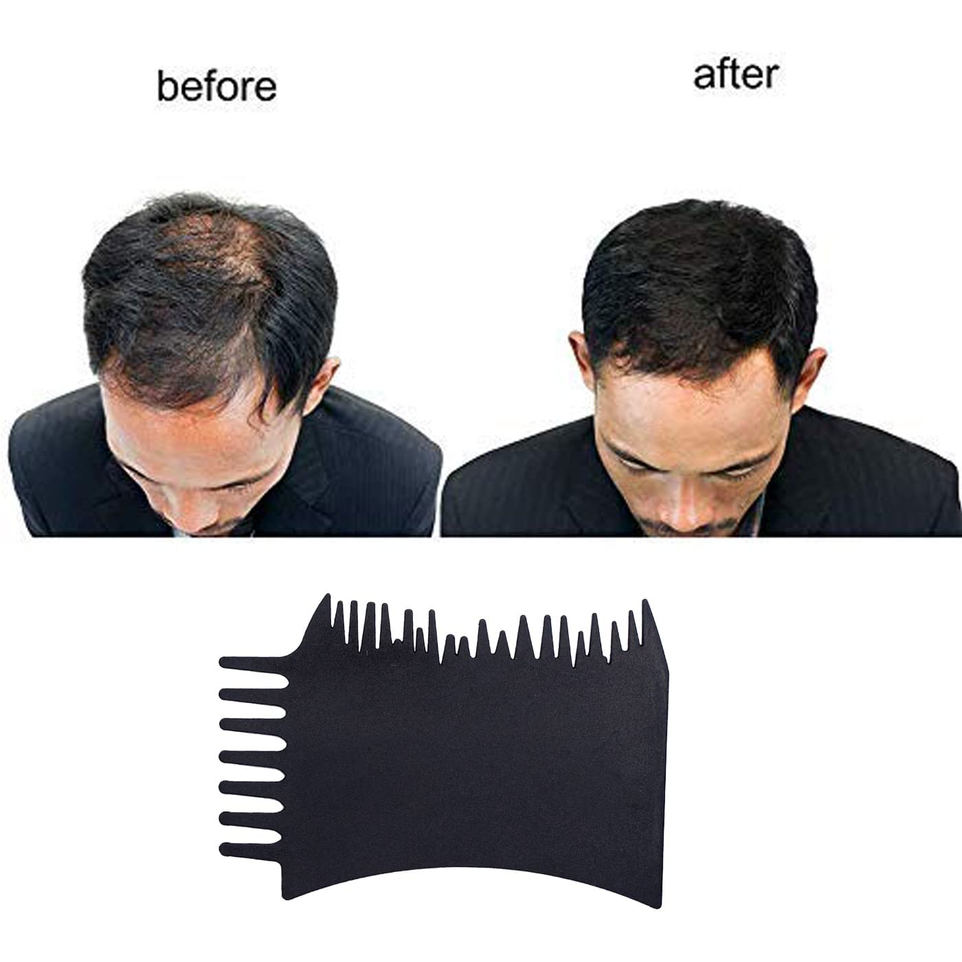 Professional Hair Fiber Forehead Pre-Hairline Comb for Men & Women - AASA Hairline Optimizer (Black) | Instant Hair Thickening & Natural Hairline Enhancement for Everyday Styling & Confidence Boost
