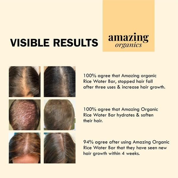 Organic Rice Water Hair Growth Bar - Natural Shampoo Alternative for Stronger, Longer Hair | Sulfate-Free & Vegan for Daily Hair Care & Scalp Nourishment | Perfect for Damaged Hair Repair & Thinning Hair Treatment
