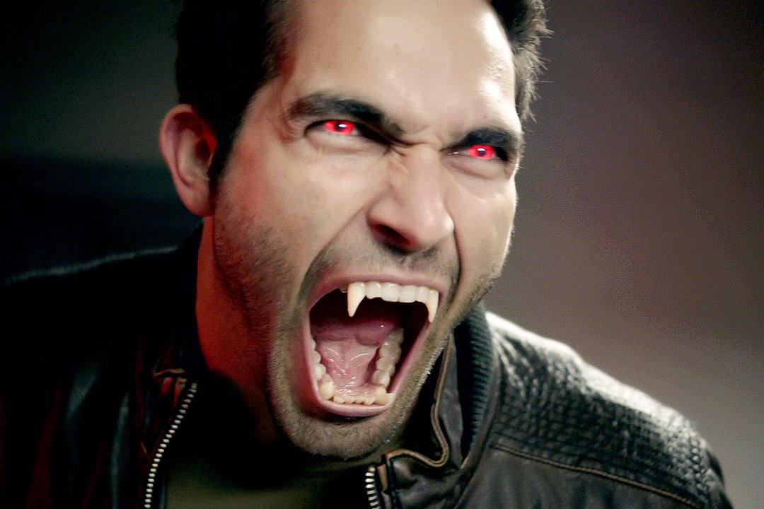 Teen Wolf Season 2 DVD | Complete TV Series Collection | Supernatural Werewolf Drama Show | Perfect for Teen Entertainment & Gift Giving