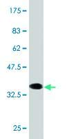 Anti-ALDH2 Mouse Monoclonal Antibody [Clone 2A7] - 100µG for Research & Diagnostics - Ideal for Western Blot, ELISA, and Immunohistochemistry
